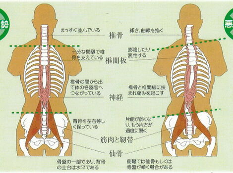03-01